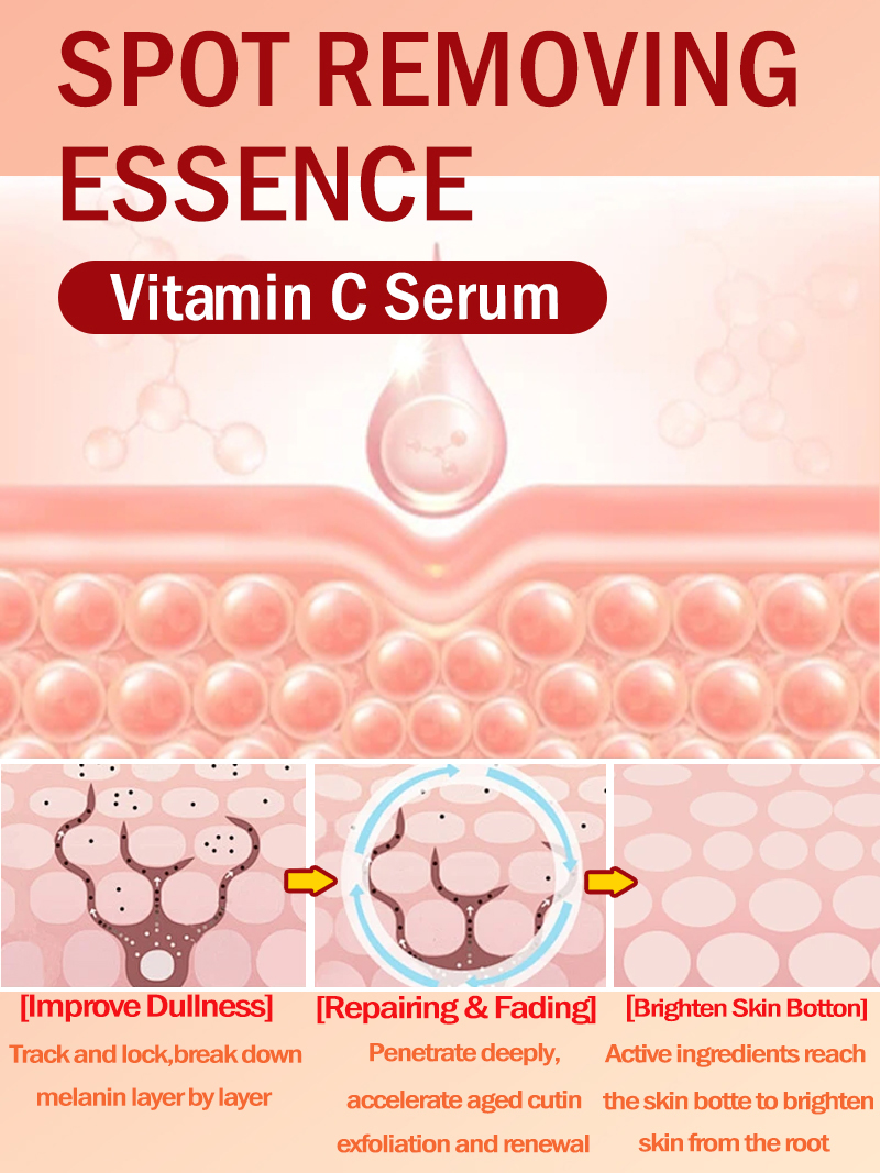 Ilumina las pecas Melasma, las - Skincare Luxury Whitening reseña y precio